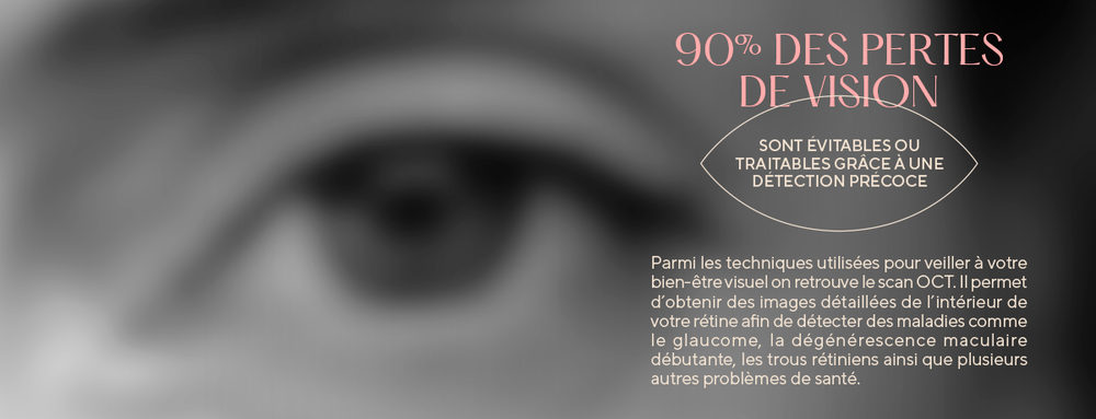 oct, tomographie retine et scan nerf optique